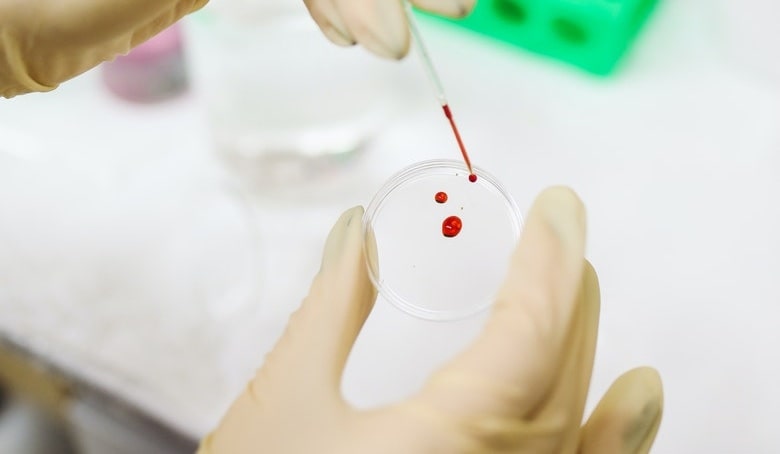 What kind of blood tests detect drug use